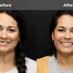 Bild von Smile Now Eugene Dentures and Implants