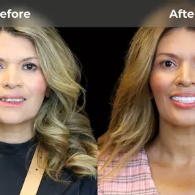 Bild von Smile Now Eugene Dentures and Implants