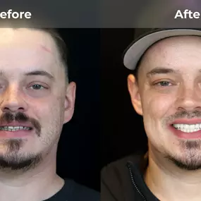 Bild von Smile Now Eugene Dentures and Implants