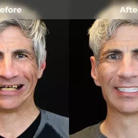 Bild von Smile Now Eugene Dentures and Implants