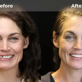 Bild von Smile Now Eugene Dentures and Implants