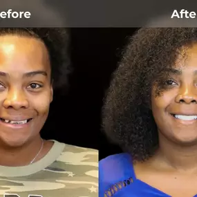 Bild von Smile Now Eugene Dentures and Implants