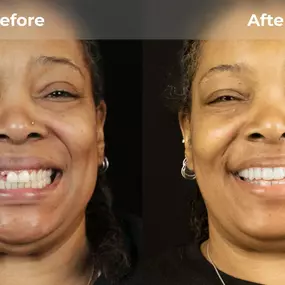 Bild von Smile Now Eugene Dentures and Implants