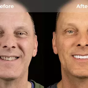 Bild von Smile Now Eugene Dentures and Implants