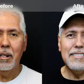 Bild von Smile Now Eugene Dentures and Implants