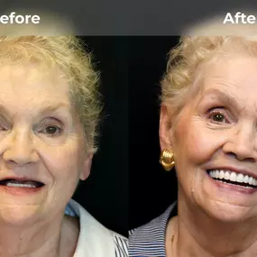 Bild von Smile Now Eugene Dentures and Implants