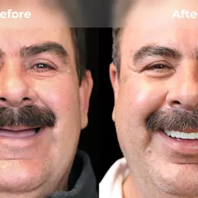 Bild von Smile Now Eugene Dentures and Implants
