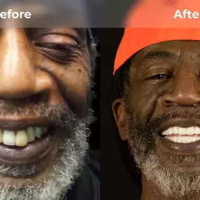 Bild von Smile Now Eugene Dentures and Implants