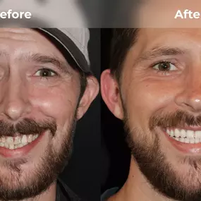 Bild von Smile Now Eugene Dentures and Implants