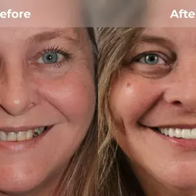 Bild von Smile Now Eugene Dentures and Implants
