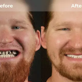 Bild von Smile Now Eugene Dentures and Implants