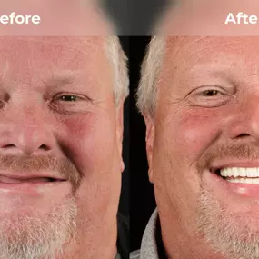 Bild von Smile Now Eugene Dentures and Implants