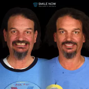 Bild von Smile Now Eugene Dentures and Implants