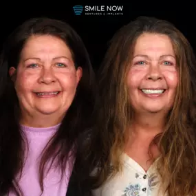 Bild von Smile Now Eugene Dentures and Implants