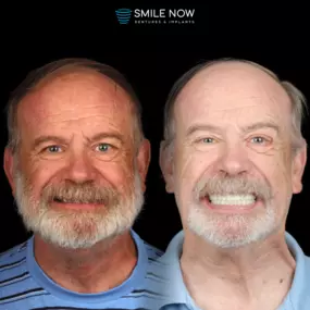 Bild von Smile Now Eugene Dentures and Implants