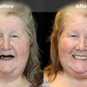 Bild von Smile Now Eugene Dentures and Implants