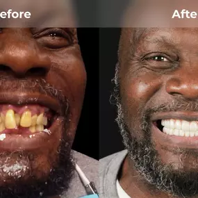 Bild von Smile Now Eugene Dentures and Implants