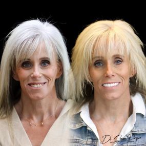 Bild von Smile Now Denver Dentures and Implants