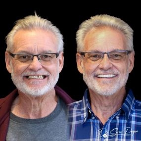 Bild von Smile Now Denver Dentures and Implants