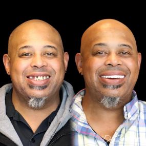 Bild von Smile Now Denver Dentures and Implants