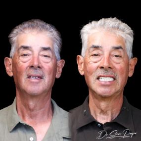 Bild von Smile Now Denver Dentures and Implants