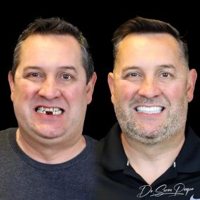 Bild von Smile Now Denver Dentures and Implants