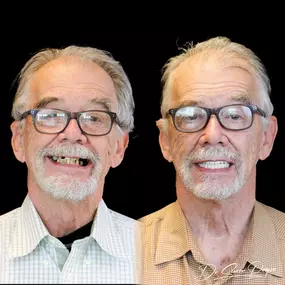 Bild von Smile Now Denver Dentures and Implants