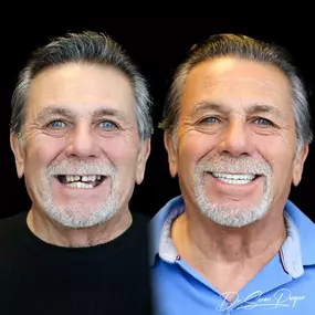 Bild von Smile Now Denver Dentures and Implants