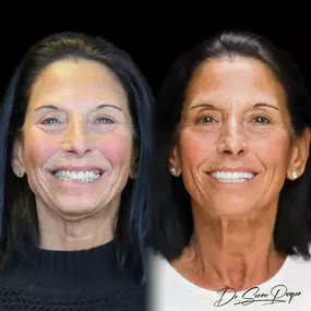 Bild von Smile Now Denver Dentures and Implants