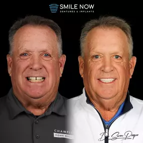 Bild von Smile Now Denver Dentures and Implants