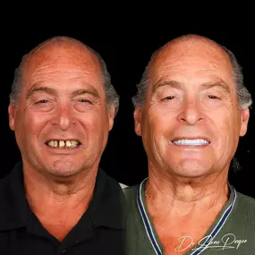 Bild von Smile Now Denver Dentures and Implants
