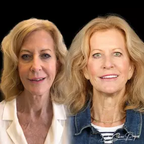 Bild von Smile Now Denver Dentures and Implants