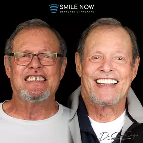 Bild von Smile Now Denver Dentures and Implants