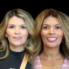 Bild von Smile Now Denver Dentures and Implants