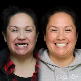 Bild von Smile Now Denver Dentures and Implants