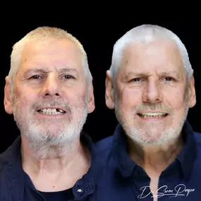 Bild von Smile Now Denver Dentures and Implants