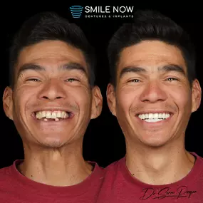 Bild von Smile Now Denver Dentures and Implants