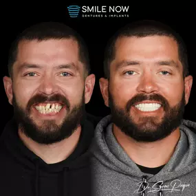 Bild von Smile Now Denver Dentures and Implants