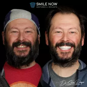 Bild von Smile Now Denver Dentures and Implants