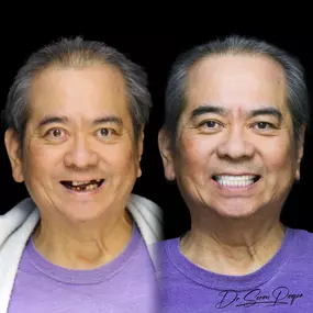 Bild von Smile Now Denver Dentures and Implants