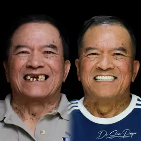 Bild von Smile Now Denver Dentures and Implants