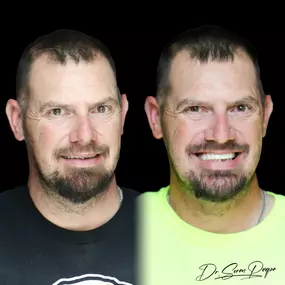 Bild von Smile Now Denver Dentures and Implants