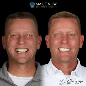 Bild von Smile Now Denver Dentures and Implants
