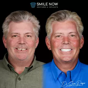 Bild von Smile Now Denver Dentures and Implants