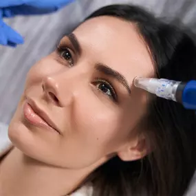 PRF Microneedling at Pure Esthetics Birmingham stimulates collagen production using platelet-rich fibrin to naturally smooth wrinkles, reduce scars, and restore youthful radiance. A safe, non-surgical treatment for glowing, healthier skin.