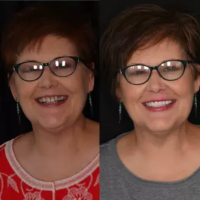 Bild von 386 Dental Studio of Gallatin