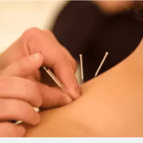 Bild von Tang Acupuncture Clinic