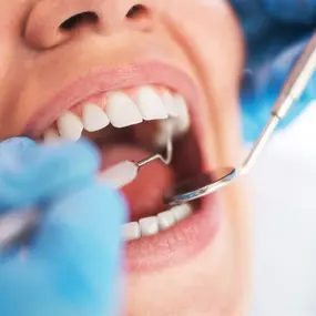 Dentist checking a patient's teeth