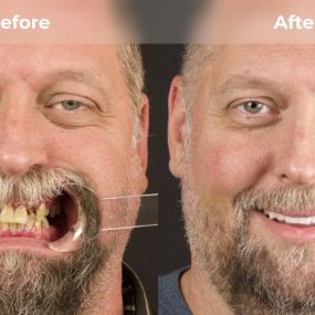 Bild von Smile Now Tri-Cities Dentures and Implants