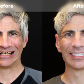 Bild von Smile Now Tri-Cities Dentures and Implants